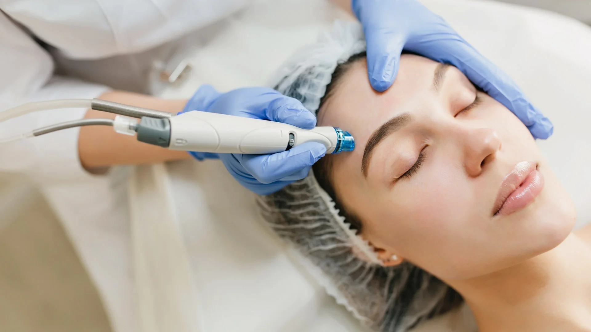 Radiofrekwencja mikroigłowa Radiofrekwencja mikroigłowa