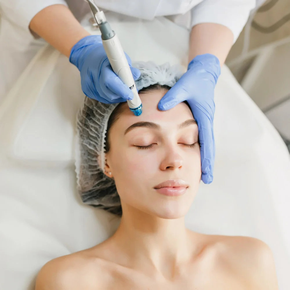 Radiofrekwencja mikroigłowa Botox Płock