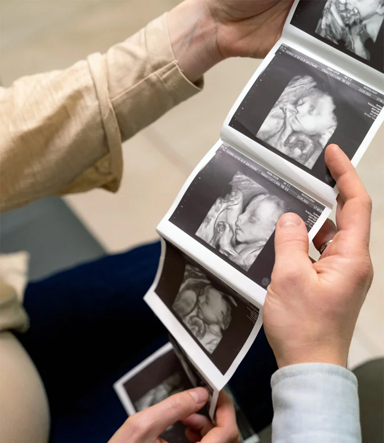 USG 3D ciąży USG 3D ciąży