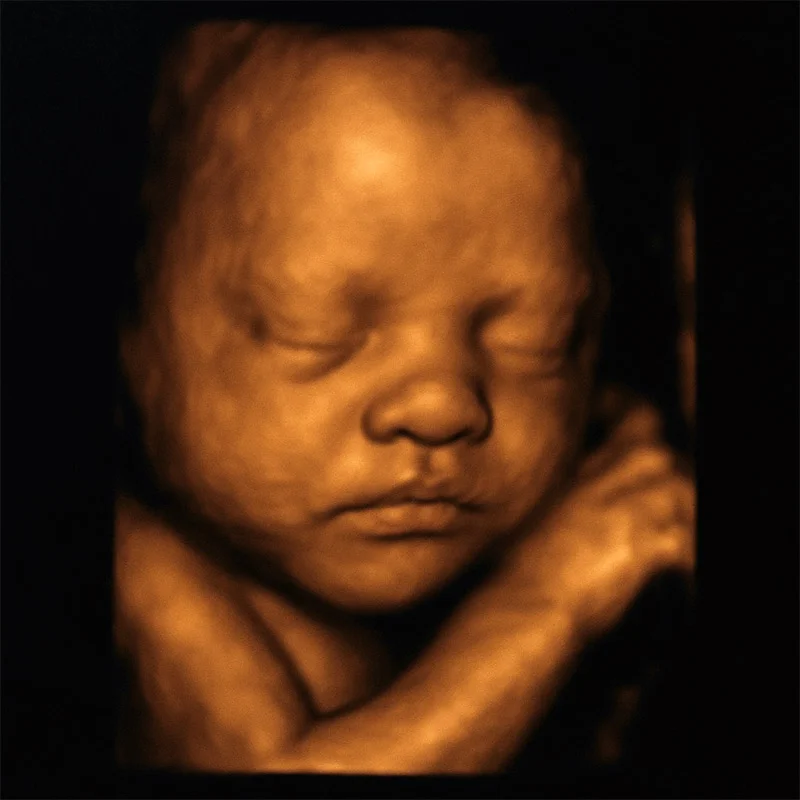 USG 3D płodu USG 4D ciąży